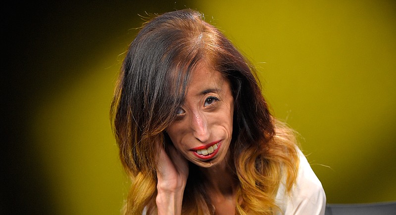 Lizzie Velasquez Once Dubbed World S Ugliest Woman Shares How She