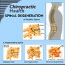 Spinal Degeneration