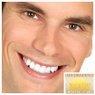 Smile Makeover