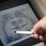 Preventative Dentistry