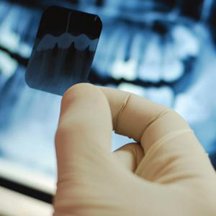 Preventive Dentistry
