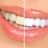 Cosmetic Dentistry