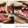 Dental Care