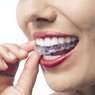 Invisalign Clear Braces