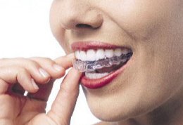 Invisalign Clear Braces