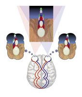 What is Vision Therapy?