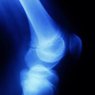 Orthopedics