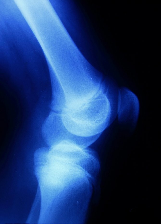 Orthopedics