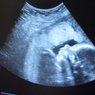 Gynecology