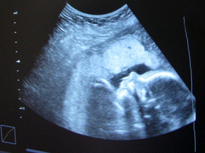 Gynecology