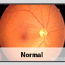 Digital Retinal Photography