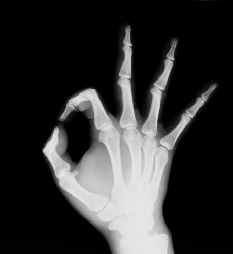 Orthopedics – X-ray on site