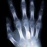 X-ray & Fracture Care