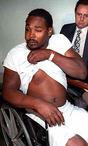 Rodney King shows the bruises he sustained at the hands of four Los
Angeles police officers in this March 6, 1991, photo. A citizen
with a video camera recorded the prolonged beating of King by four
white police officers. The infamous event marks its 10th
anniversary today.