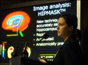 Lisa Mosconi of the Department of Psychiatry at the New York University School of Medicine speaks at a press briefing at the Alzheimer's Assn.'s International Conference on Prevention of Dementia on Sunday in Washington.