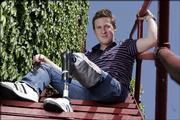 Lawrence drummer Billy Brimblecom was diagnosed with Ewing's sarcoma, leading to the amputation of his left leg below his knee in August. Friends are throwing a music/comedy benefit on Saturday to help him cover the $30,000 cost of a new prosthetic leg.
