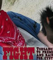 Tease photo