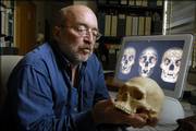 David Frayer, professor of anthropology at Kansas University, holds a replica cast of the skull of an Australian aborigine. Frayer and an international team of researchers are disputing claims that 18,000-year-old remains found on the Indonesian island of Flores were those of a previously unknown species of little people, nicknamed hobbits.