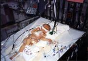 Hannah Fowler, now 12, recovers from an open-heart surgery conducted when she was just 3 days old at Wesley Medical Center in Wichita to repair a blocked valve. Hannah's mother, Susan, calls her daughter a "miracle baby" because doctors didn't expect her to live past infancy.