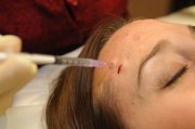 Dr. Carla Phipps injects Botox into the forehead of Karrey Britt, assistant assignment director for the Lawrence Journal-World, at the Laser and Cosmetic Center in Lawrence.