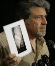 Bigfoot hunter Tom Biscardi holds a photo of what he claims to be the mouth and teeth of a deceased bigfoot or sasquatch creature during a Friday news conference in Palo Alto, Calif.