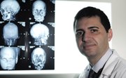 Dr. Joan Pere Barret, was the lead surgeon of a 30-member medical team that has carried out the world’s first full-face transplant. On his left are magnetic resonance images of the man who underwent the transplant at the Vall d’Hebron Hospital in Barcelona, Spain. The operation gave him a new nose, skin, jaws, cheekbones, teeth and other features.