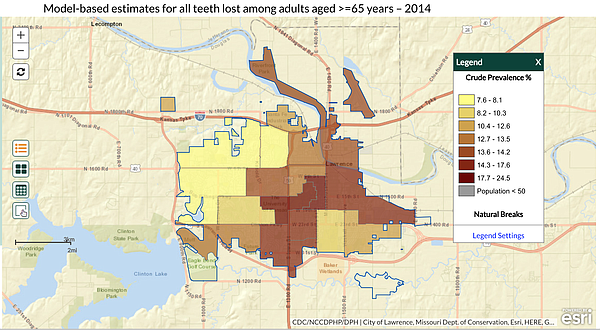 This map from the Centers for Disease Control and Prevention 500 Cities project shows the percentages of seniors in Lawrence with complete tooth loss, broken down by census tracts. 