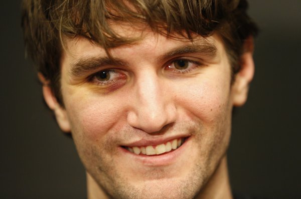 Kansas center Jeff Withey smiles with a black eye while talking with media members during a day of practices and press conference for teams in the South Regional at Cowboys Stadium in Arlington, Texas on Thursday, March 28, 2013. Withey suffered the shiner during the Jayhawks' last game against North Carolina.