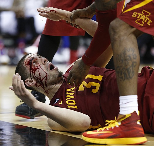 Iowa State forward Georges Niang lies on the floor bleeding from a gash above his eye suffered late in the second half on Friday, March 14, 2014 at Sprint Center in Kansas City, Missouri.
